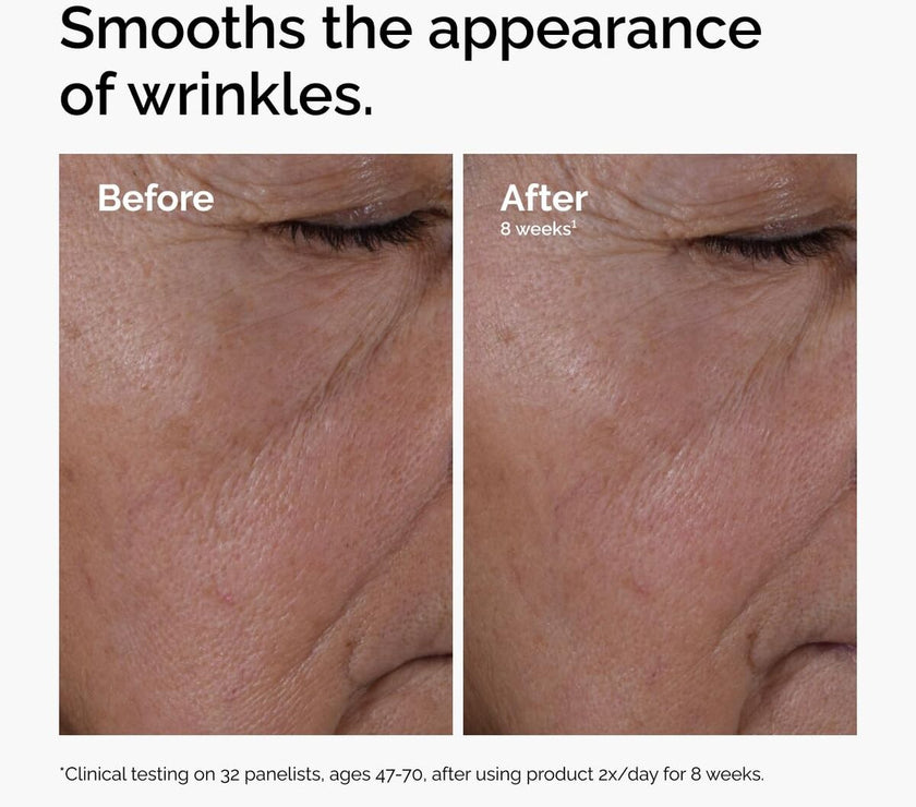 V3HF67E4C72BF968AAB588E4F85969EDD2DR7415509P3