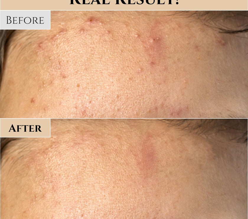 V3HA8085F716AF828FB8CA9EE517E7F0B55R7528333P8